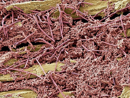 Các nhà nghiên cứu nhuộm màu và phóng đại 1.000 lần kính thước vi khuẩn.