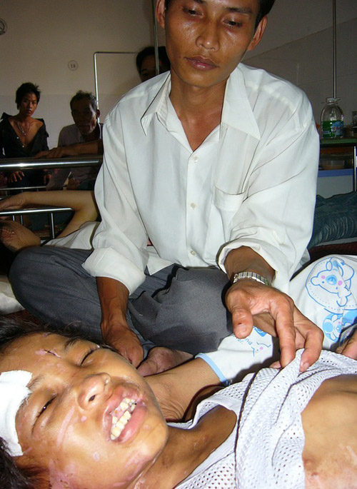 Hào Anh bị chủ trại tôm giống dùng kềm kẹp môi chảy máu, bẻ gãy nhiều chiếc răng. Ngoài mẹ và ngoại, cha dượng là ông Nguyễn Xuân Hùng túc trực tại bệnh viện ngày đêm để chăm sóc nạn nhân.