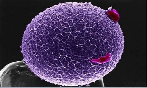 Tế bào trứng có hình cầu.