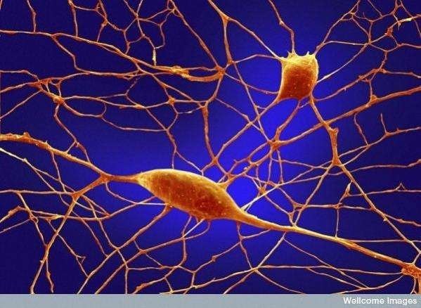 Trong hình là tế bào thần kinh của não người, chúng liên kết với nhau như một mạng lưới chằng chịt.