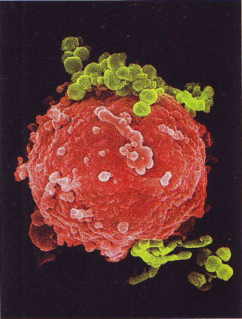 Tế bào lympho B (tế bào sản xuất kháng thể) đang bị các vi khuẩn (màu xanh) bám vào.