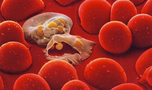 Hai tế bào máu bị nhiễm vi khuẩn sốt rét đang chuẩn bị tấn công và lây nhiễm các tế bào xung quanh.