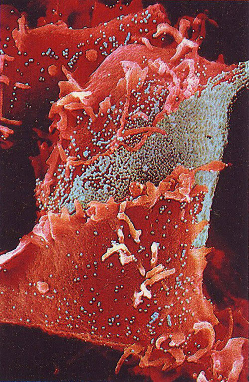 Hình ảnh một virus bệnh cúm thông thường. Virus này đang liên tục tự biến đổi và đồng thời sản sinh ra các tác nhân gây bệnh (màu xanh) vào hệ thống miễn dịch.