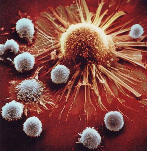 Các tế bào T (màu trắng) đang bao vây và chuẩn bị tấn công một tế bào ung thư.