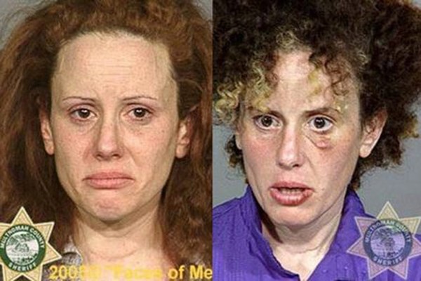 Trước và sau khi nghiện.