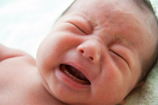 Khóc không ra nước mắt. Bé có thể khóc rất nhiều nhưng thực tế thì lại không có nước mắt. Những giọt nước mắt đầu tiên của bé xuất hiện khi bé 1-3 tháng đầu.