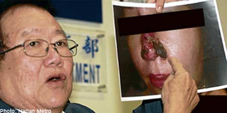 Luật sư công bố bức ảnh cho thấy tình trạng nhiễm trùng mũi nghiêm trọng của thân chủ.