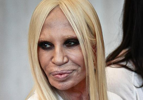 Gương mặt Donatella là một điển hình của việc tiêm botox.