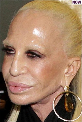 Nổi tiếng với những ca phẫu thuật thẩm mỹ nâng mũi, bơm môi, tiêm botox... để giữ gìn nhan sắc, nhưng gương mặt Donatella Versace đang ngày càng biến dạng khiến nhiều người đối diện phải kinh sợ.