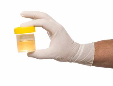 Nước tiểu có màu tối - tăng bilirubin trong máu sẽ làm cho màu sắc của nước tiểu thay đổi từ màu vàng sẫm đến nâu. Nếu bạn nhận thấy có sự thay đổi màu sắc của nước tiểu, hãy đến gặp bác sĩ sớm nhất có thể.