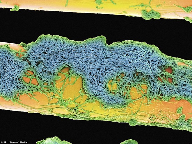Bức ảnh này cho thấy một lượng lớn vi khuẩn (được tô vàng) bám trên nướu răng.
