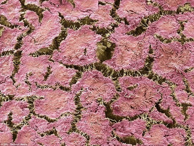 Bức ảnh này là bề mặt của một mảng bám răng được tô màu hồng để làm rõ các hạt cực nhỏ không thể thấy bằng mắt thường.