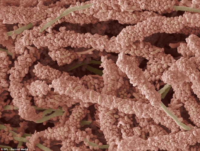 Hình ảnh phóng to của một con vi khuẩn hình thành mảng bám trên răng.
