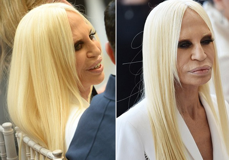 Bà Donatella Versace với khuôn mặt nhiều nếp nhăn, gầy guộc, xuống sắc trầm trọng.
