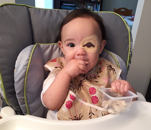 Từ khi sinh ra, cô bé Layla đã bị đục thủy tinh thể nên phải dùng miếng che mắt 2 tiếng đồng hồ mỗi ngày.