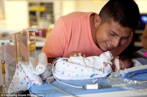 Bé Andre chào đời khi mới được hơn 23 tuần tuổi, bé nặng 0,62 kg và phải ở trong lồng kính chăm sóc đặc biệt tới 130 ngày.