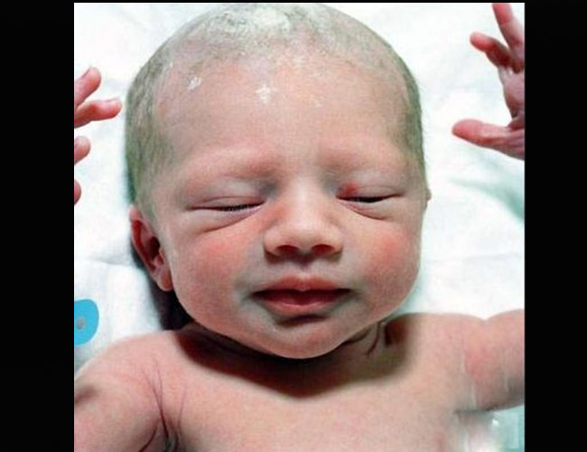 Khi mới chào đời, khắp mặt và người bé vẫn phủ một lớp màng màu vàng trắng mỏng. Đây là lớp màng bảo vệ bé khi còn trong tử cung của người mẹ.