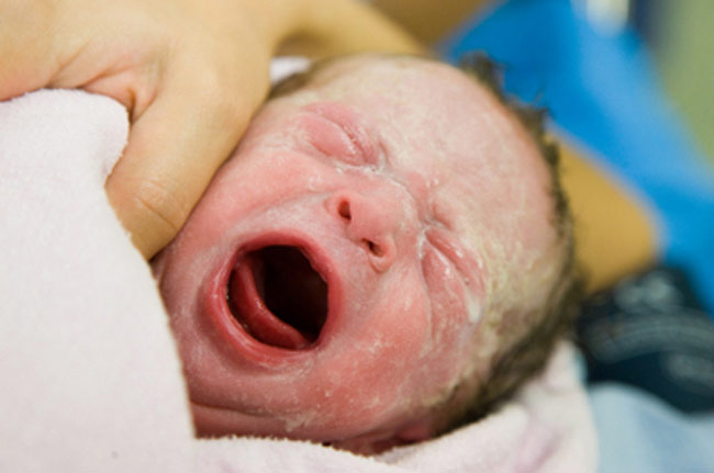 Trẻ sơ sinh khi mới được đưa ra gặp mẹ, trên người bé vẫn còn dính rất nhiều dịch nhớt lcủa nước ối và nhau thai lẫn máu.
