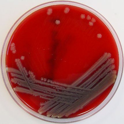 Vi khuẩn ăn thịt người có dạng hình que, có 1 lớp lông quanh thân với kích thước siêu nhỏ chỉ từ 0,3 đến 1 micromet, chiều ngang và dài từ 1 đến 3 micromet...