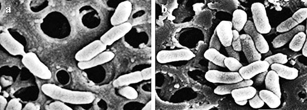 Vi khuẩn ăn thit người có tên khoa học là Aeromonas hydrophila dạng hình que, sống chủ yếu trong môi trường ấm, nước bẩn và chất thải chủ yếu gây bệnh cho cá, tôm và các loài ếch..