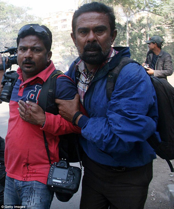 Ông Asif Hassan, phóng viên ảnh của AFP đang được đưa đến bệnh viện sau khi bị trúng đạn vào ngực trong cuộc đụng độ xảy ra ở Karachi, Pakistan.