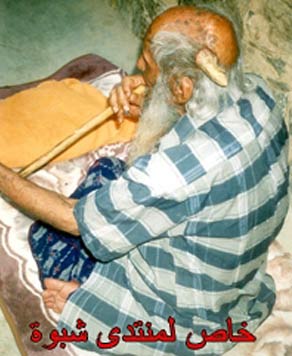 Cụ Saleh Talib Saleh (102 tuổi) sống tại tỉnh Shabwa, Yemen với chiếc sừng mọc trên đầu.