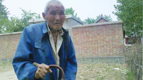 Ông lão Vương Duẫn Châu ở huyện Huy Khê, thành phố Hoài Bắc, Trung Quốc với chiếc sừng mọc trên tay.