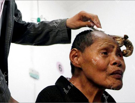 Một người phụ nữ đến từ làng Zhanggang, thành phố Đăng Châu, tỉnh miền trung Hà Nam, Trung Quốc.