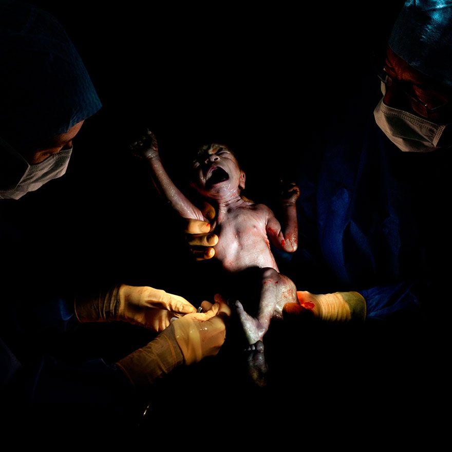 Cho đến nay, nhiếp ảnh gia người Pháp đã chụp được 40 ca sinh con bằng phương pháp mổ.