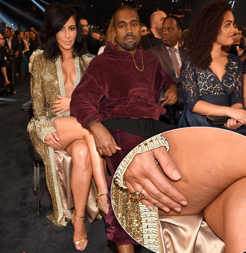 Kim Kardashian mặc váy xẻ tự tin khoe chân trong lúc ngồi xem lễ trao giải Grammy 2015 cùng chồng. Tuy nhiên vùng da ở đùi của cô lại chẳng mấy nuột nà.