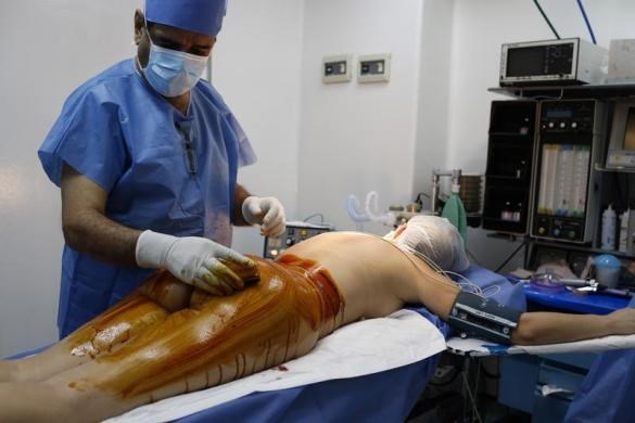 Khử trùng mông khi chuẩn bị phẫu thuật.