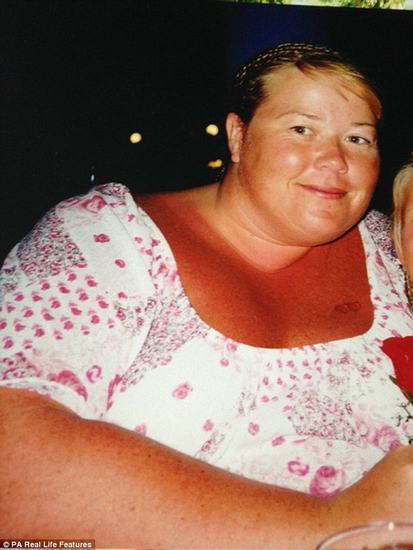 Karen từng nặng gần 200kg nhưng nhờ chi 10.000 bảng Anh (khoảng 33 triệu đồng) phẫu thuật cắt dạ dày để thực hiện giấc mơ giảm cân.