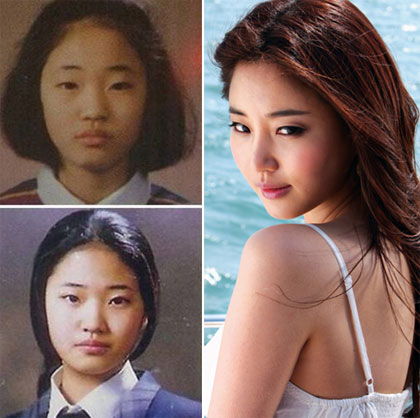 Hoa hậu Hàn Quốc 2000 Kim Sa Rang được cho là đã chỉnh sửa mắt, mũi.