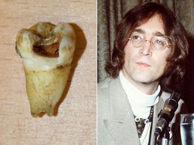 Năm 2011, những chiếc răng của John Lennon được một nha sĩ người Canada mua với giá 31.000 USD để trưng bày trong phòng phẫu thuật của mình cũng như đem đi giới thiệu ở các phòng khám nha khoa khác.