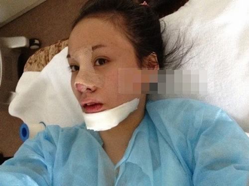 Bà Tưng đã mạnh dạn công khai cận cảnh quá trình phẫu thuật thẩm mỹ đầy đau đớn với khuôn mặt sưng húp.