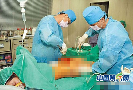 Trần Duy Thiên đã thực hiện liên tiếp 3 cuộc phẫu thuật.