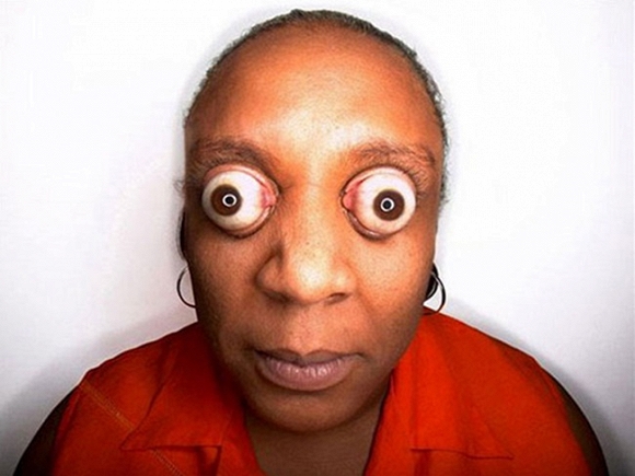 Kỷ lục người phụ nữ có đôi mắt lồi nhiều nhất thuộc về cô Kim Goodman (Mỹ) với thành tích làm mắt lồi ra khỏi hốc mắt tới 11mm.