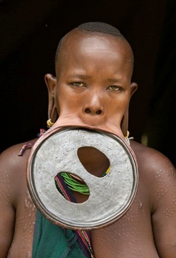 Ataye Eligidagne thuộc bộ lạc Surma xác lập kỷ lục đeo đĩa môi lớn nhất thế giới khi có thể đeo vừa chiếc đĩa có đường kính lên tới 19,5cm và chu vi 59,5cm.