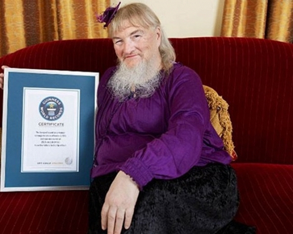 Người phụ nữ có bộ râu dài nhất thế giới là bà Vivian Wheeler (Mỹ) với chiều dài lên tới 25,5cm.