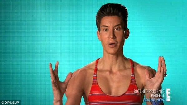 Justin Jedlica đã quyết định tiến hành hơn 190 cuộc phẫu thuật thẩm mỹ để có thân hình giống búp bê Ken.