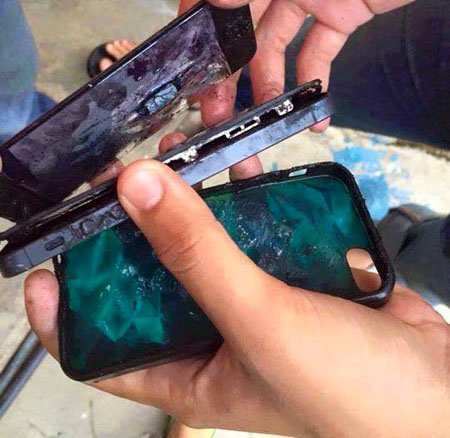 Nam thanh niên bị bỏng nặng vì iPhone phát nổ trong túi quần