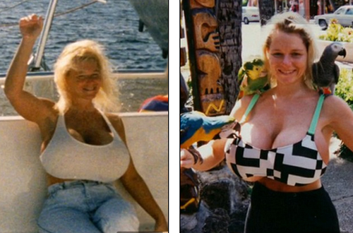 Hình ảnh của bà cách đây 20 năm khi đã nâng ngực xong.