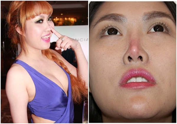 Phi Thanh Vân đang gánh chịu hậu quả phẫu thuật thẩm mỹ 10 năm trước ở chiếc mũi.