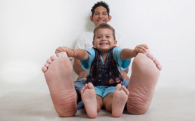 Người đàn ông có bàn chân lớn nhất thế giới. Jeison Orlando Rodriguez Hernandez, công dân Venezuela 20 tuổi, sở hữu bàn chân to gần bằng một em bé với kích thước 40.1 cm (chân phải) và 39.6 cm (chân trái).