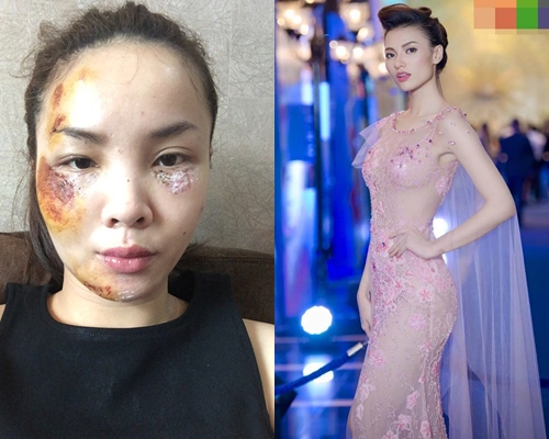 Showbiz Việt ngày 18/9: Yến Trang sexy sau tai nạn, Hồng Quế 