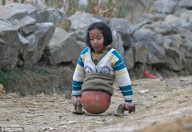 Qian Hongyan đến từ Vân Nam năm 10 tuổi. Cô bé bị mất 2 chân vào năm 2000 sau khi suýt chết vì một tai nạn xe. Ảnh: Reuters.