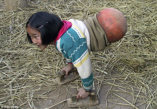 Cô bé đã truyền cảm hứng cho nhiều người nhờ hình ảnh đi lại với quả bóng rổ. Ảnh: Reuters.