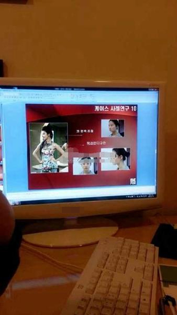 Hình ảnh được cho là của Lưu Diệc Phi xuất hiện trên máy tính đang phác thảo thẩm mỹ.