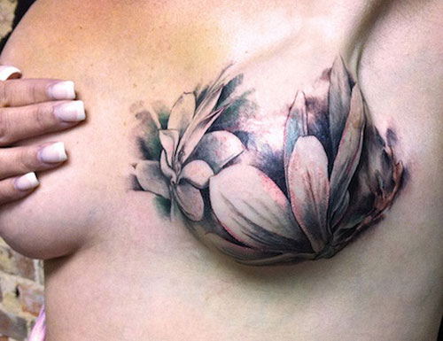 Một người phụ nữ dũng cảm để lộ hình xăm trên ngực sau ca phẫu thuật ung thư vú.