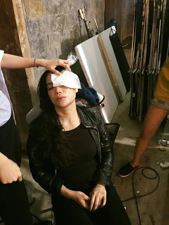 Trương Ngọc Ánh gặp tai nạn đúng ngày sinh nhật trên phim trường
